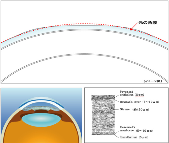 日本人の角膜形状に合わせて開発されたデザイン イメージ図